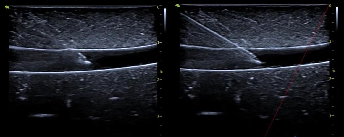 M&aacute;y si&ecirc;u &acirc;m 5D Vinno S100